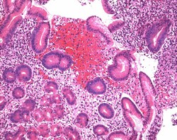 MilliporeSigma™ Mayer's Hemalum Solutions for Microscopy